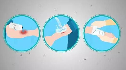 危险化学品沾身应急措置